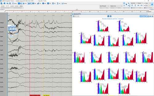 SW EEG analisi FFT