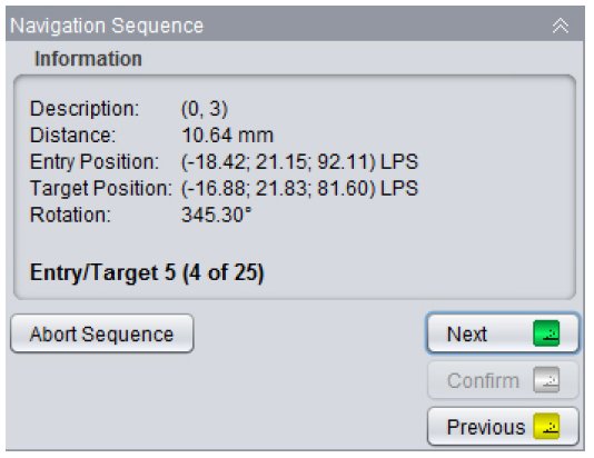 TMS navig value